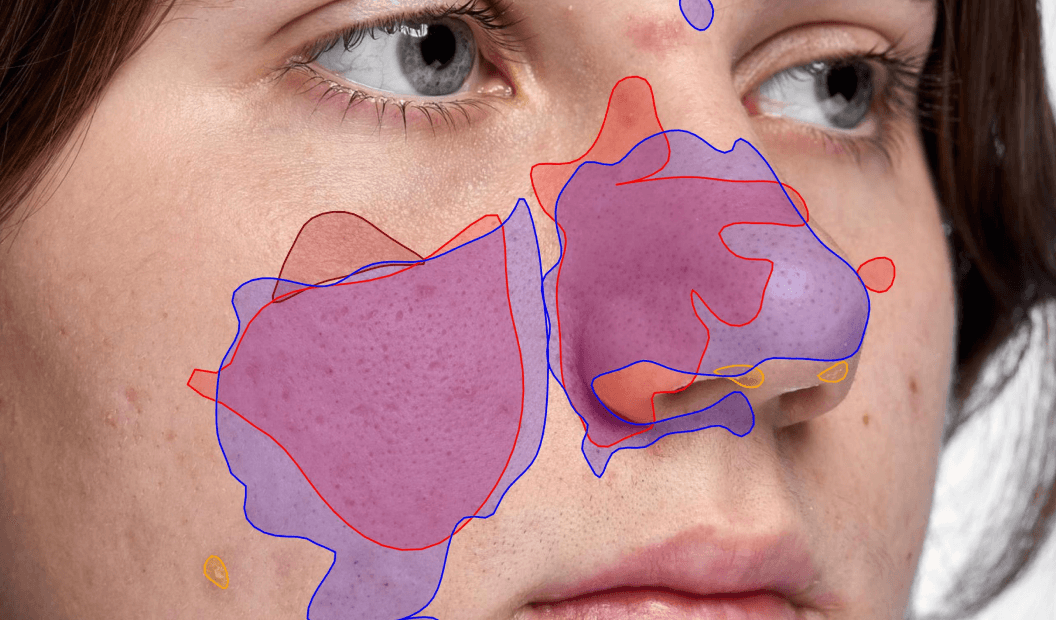 вторые после